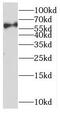 Poly(ADP-Ribose) Polymerase Family Member 6 antibody, FNab06159, FineTest, Western Blot image 