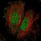 Spermatogenesis Associated 33 antibody, HPA073096, Atlas Antibodies, Immunocytochemistry image 