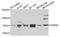 Aspartyl-TRNA Synthetase 2, Mitochondrial antibody, STJ110123, St John