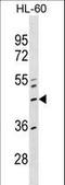 Zinc Finger Protein 589 antibody, LS-C157479, Lifespan Biosciences, Western Blot image 