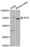 Spleen Associated Tyrosine Kinase antibody, A2123, ABclonal Technology, Western Blot image 