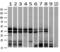 Heterogeneous Nuclear Ribonucleoprotein F antibody, GTX84356, GeneTex, Western Blot image 