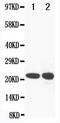 Glutathione Peroxidase 2 antibody, LS-C312955, Lifespan Biosciences, Western Blot image 