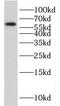 Cell Division Cycle 73 antibody, FNab04013, FineTest, Western Blot image 