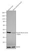 Actin Alpha 2, Smooth Muscle antibody, MA5-15871, Invitrogen Antibodies, Western Blot image 