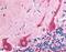 Protein Kinase C Zeta antibody, MBS396068, MyBioSource, Immunohistochemistry paraffin image 