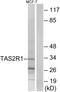 Taste 2 Receptor Member 1 antibody, A08714, Boster Biological Technology, Western Blot image 