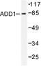 SRBP1 antibody, LS-C175911, Lifespan Biosciences, Western Blot image 