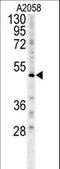 Forkhead box protein C2 antibody, LS-C166218, Lifespan Biosciences, Western Blot image 