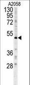 Forkhead Box C2 antibody, LS-C166218, Lifespan Biosciences, Western Blot image 