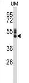 Synaptotagmin 7 antibody, LS-C161656, Lifespan Biosciences, Western Blot image 