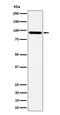 Tensin 4 antibody, M07240, Boster Biological Technology, Western Blot image 