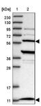 Trafficking Protein Particle Complex 12 antibody, NBP1-84500, Novus Biologicals, Western Blot image 