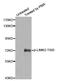 LIM Domain Kinase 2 antibody, STJ22229, St John