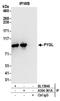 Glycogen phosphorylase, liver form antibody, A304-361A, Bethyl Labs, Immunoprecipitation image 