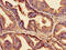 Claudin 3 antibody, CSB-PA13119A0Rb, Cusabio, Immunohistochemistry paraffin image 