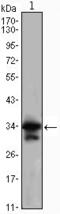 Cyclin Dependent Kinase 1 antibody, GTX82995, GeneTex, Western Blot image 