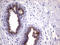 Myotilin antibody, M04663, Boster Biological Technology, Immunohistochemistry paraffin image 
