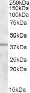 NME/NM23 Family Member 9 antibody, PA5-18932, Invitrogen Antibodies, Western Blot image 