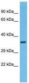 Tripartite Motif Containing 16 antibody, TA330797, Origene, Western Blot image 