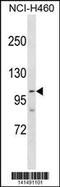 Poly(ADP-Ribose) Polymerase 1 antibody, 60-741, ProSci, Western Blot image 