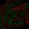 TRNA Methyltransferase 11 Homolog antibody, HPA030473, Atlas Antibodies, Immunofluorescence image 