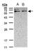 Xylulokinase antibody, TA308165, Origene, Western Blot image 