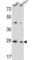 Transmembrane 4 L Six Family Member 4 antibody, abx034497, Abbexa, Western Blot image 