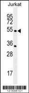 Cholinergic Receptor Nicotinic Alpha 2 Subunit antibody, 56-130, ProSci, Western Blot image 