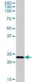 NADH:Ubiquinone Oxidoreductase Subunit B10 antibody, H00004716-B01P, Novus Biologicals, Western Blot image 