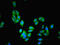 Phenylalanine Hydroxylase antibody, CSB-PA017396LA01HU, Cusabio, Immunofluorescence image 