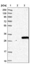 Trans-Golgi Network Vesicle Protein 23 Homolog B antibody, NBP1-88090, Novus Biologicals, Western Blot image 