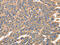 Interferon Regulatory Factor 1 antibody, CSB-PA090613, Cusabio, Immunohistochemistry paraffin image 