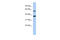 Retinol Dehydrogenase 10 antibody, 26-761, ProSci, Western Blot image 