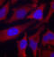 Synapsin I antibody, STJ22426, St John