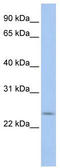 PRELI Domain Containing 2 antibody, TA337600, Origene, Western Blot image 