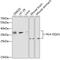 Major Histocompatibility Complex, Class II, DQ Alpha 1 antibody, GTX32654, GeneTex, Western Blot image 