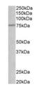 Nerve Growth Factor Receptor antibody, orb125218, Biorbyt, Western Blot image 