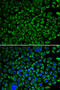 Coagulation Factor X antibody, STJ23593, St John