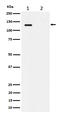 Minichromosome Maintenance Complex Component 2 antibody, P00374-1, Boster Biological Technology, Western Blot image 