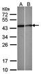 Selenophosphate synthetase 1 antibody, orb73675, Biorbyt, Western Blot image 