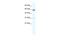 Zinc Finger Protein 491 antibody, A17629, Boster Biological Technology, Western Blot image 