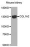 Collagen Type I Alpha 2 Chain antibody, LS-B13885, Lifespan Biosciences, Western Blot image 