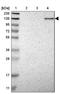 Protocadherin 7 antibody, NBP1-88610, Novus Biologicals, Western Blot image 
