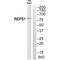 RALBP1 Associated Eps Domain Containing 1 antibody, A09419, Boster Biological Technology, Western Blot image 