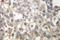 Tubulin Gamma 1 antibody, LS-C176360, Lifespan Biosciences, Immunohistochemistry paraffin image 