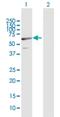 Chromosome 1 Open Reading Frame 87 antibody, H00127795-B01P, Novus Biologicals, Western Blot image 