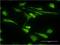 Stress Induced Phosphoprotein 1 antibody, H00010963-M35, Novus Biologicals, Immunocytochemistry image 