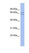 SLU7 Homolog, Splicing Factor antibody, NBP1-56697, Novus Biologicals, Western Blot image 