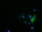 Histone Deacetylase 6 antibody, GTX84379, GeneTex, Immunofluorescence image 